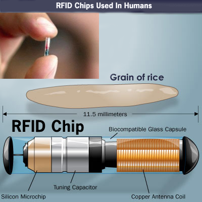 microchip bajo la piel